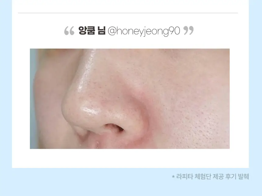 [블랙헤드 모공케어] H2 수소 아쿠아 워터 필링기 JOC-H2 상세페이지 6